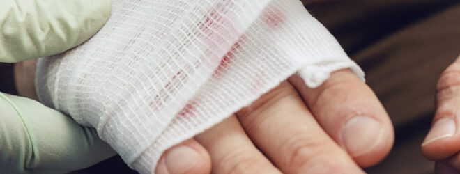 Doctor bandaging a businessman's hand.
